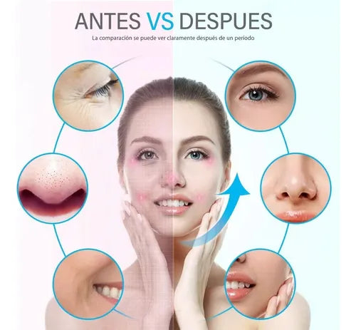 Limpiador Peeling Facial Ultrasónico