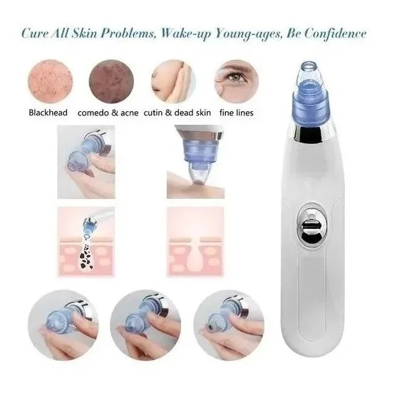 Derma Suction: EXTRACTOR PUNTO NEGRO