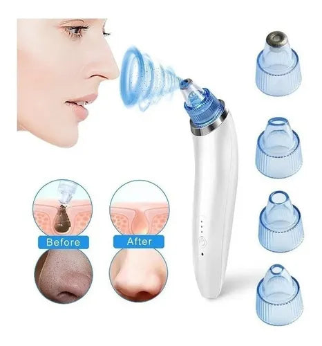 Derma Suction: EXTRACTOR PUNTO NEGRO
