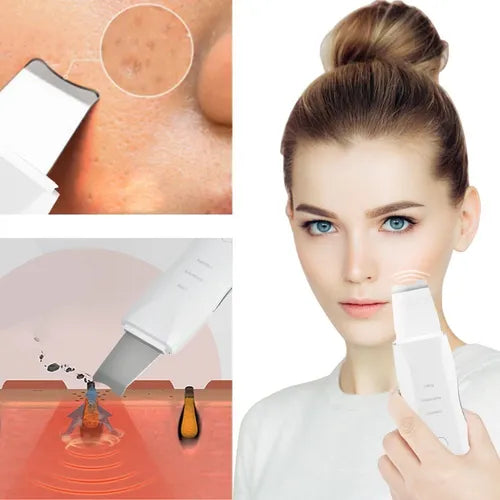 Limpiador Peeling Facial Ultrasónico